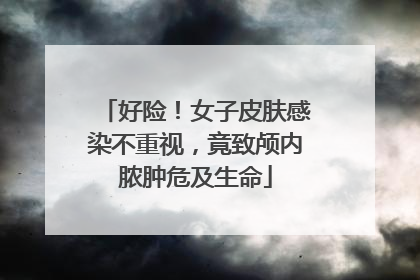 好险！女子皮肤感染不重视，竟致颅内脓肿危及生命